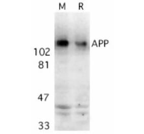 Western Blot - Anti-Amyloid Precursor Protein Antibody (A283878) - Antibodies.com