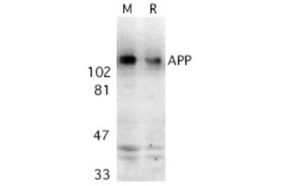 Western Blot - Anti-Amyloid Precursor Protein Antibody (A283878) - Antibodies.com