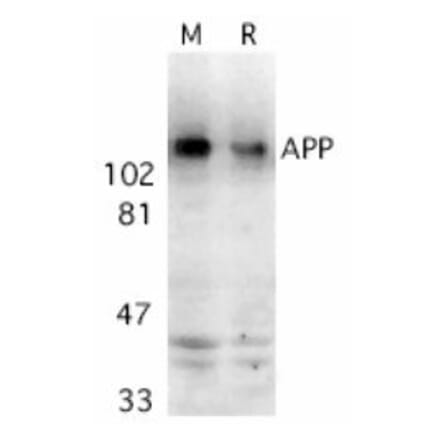 Western Blot - Anti-Amyloid Precursor Protein Antibody (A283878) - Antibodies.com