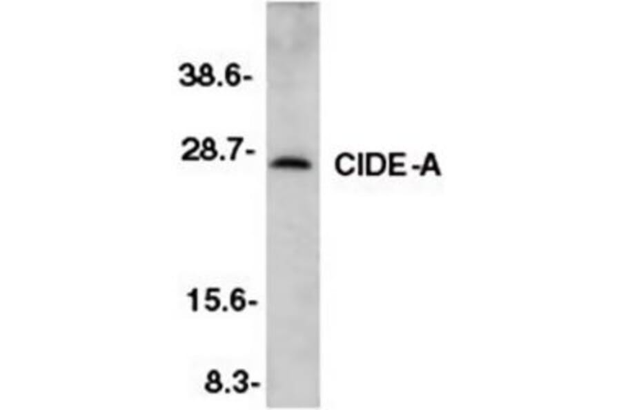 Western Blot - Anti-CIDE A Antibody (A283879) - Antibodies.com