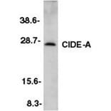 Western Blot - Anti-CIDE A Antibody (A283879) - Antibodies.com