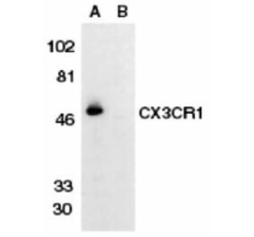 Western Blot - Anti-CX3CR1 Antibody (A283882) - Antibodies.com