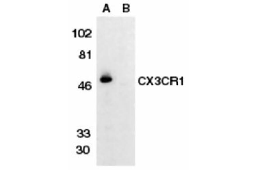 Western Blot - Anti-CX3CR1 Antibody (A283882) - Antibodies.com