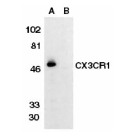 Western Blot - Anti-CX3CR1 Antibody (A283882) - Antibodies.com