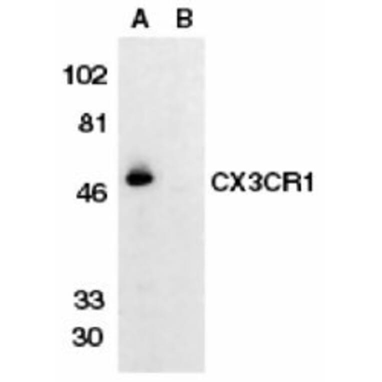 Western Blot - Anti-CX3CR1 Antibody (A283882) - Antibodies.com