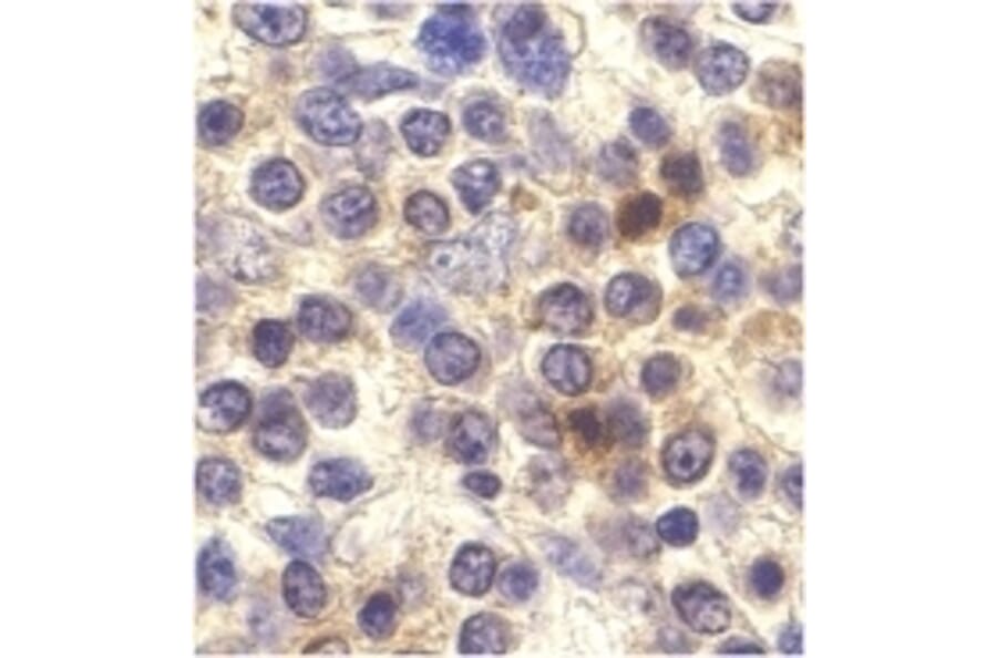 Immunohistochemistry - Anti-CX3CR1 Antibody (A283882) - Antibodies.com