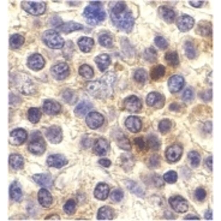 Immunohistochemistry - Anti-CX3CR1 Antibody (A283882) - Antibodies.com