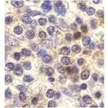 Immunohistochemistry - Anti-CX3CR1 Antibody (A283882) - Antibodies.com