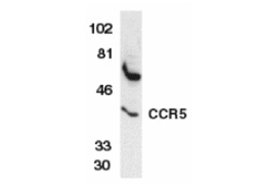 Western Blot - Anti-CCR5 Antibody (A283884) - Antibodies.com