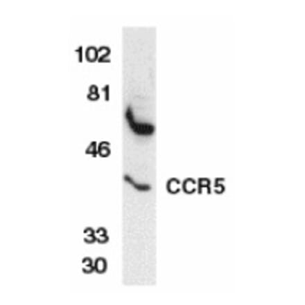 Western Blot - Anti-CCR5 Antibody (A283884) - Antibodies.com