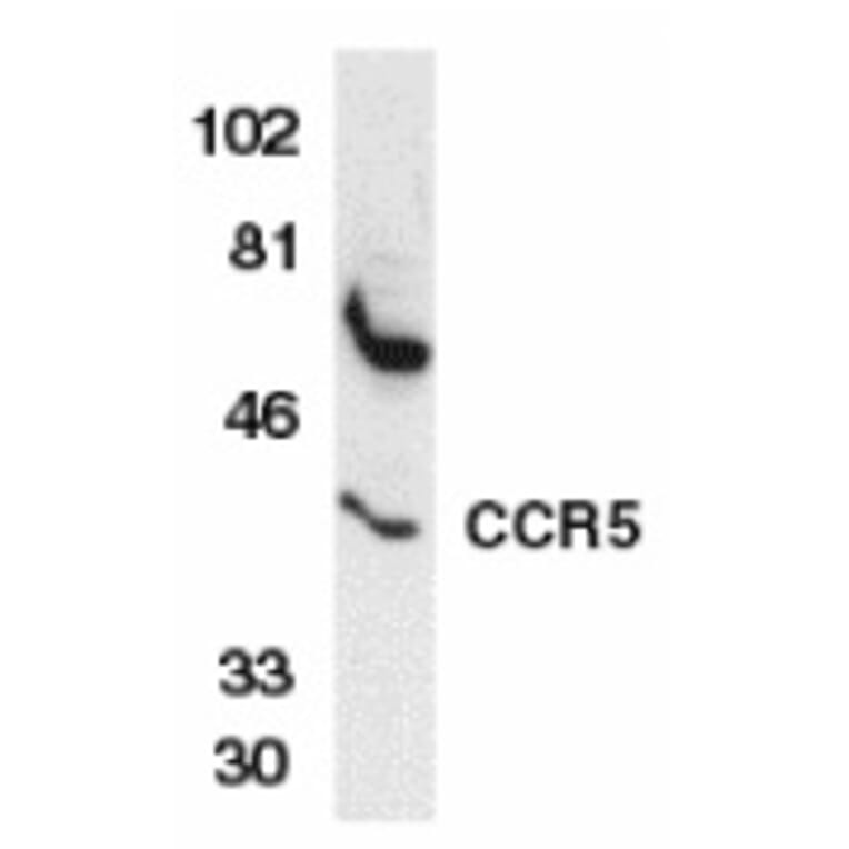 Western Blot - Anti-CCR5 Antibody (A283884) - Antibodies.com