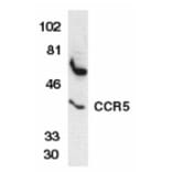 Western Blot - Anti-CCR5 Antibody (A283884) - Antibodies.com