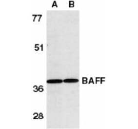 Western Blot - Anti-BAFF Antibody (A283889) - Antibodies.com