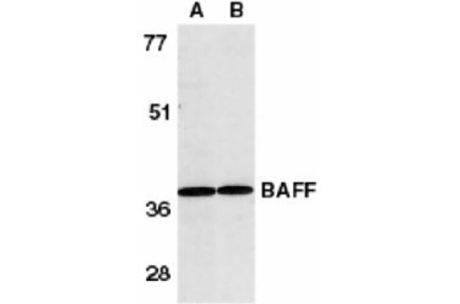 Western Blot - Anti-BAFF Antibody (A283889) - Antibodies.com