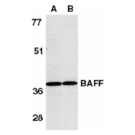 Western Blot - Anti-BAFF Antibody (A283889) - Antibodies.com