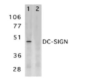 Western Blot - Anti-DC-SIGN Antibody (A283893) - Antibodies.com
