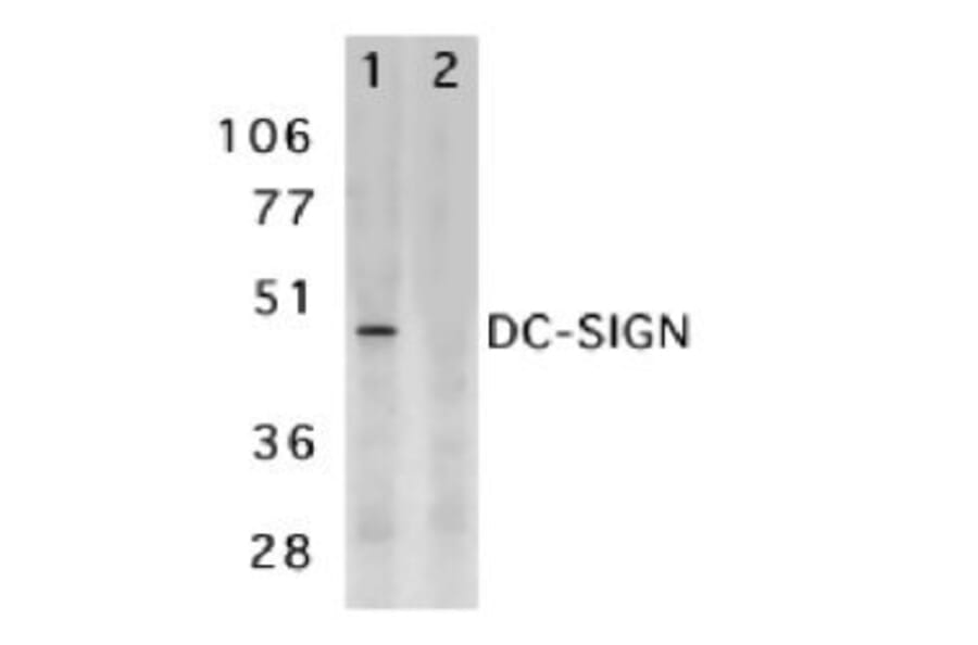 Western Blot - Anti-DC-SIGN Antibody (A283893) - Antibodies.com