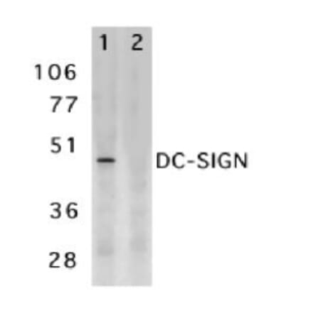 Western Blot - Anti-DC-SIGN Antibody (A283893) - Antibodies.com