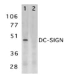 Western Blot - Anti-DC-SIGN Antibody (A283893) - Antibodies.com