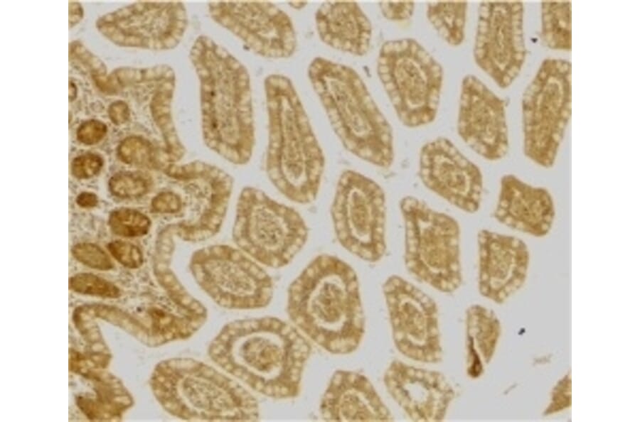 Immunohistochemistry - Anti-DC-SIGN Antibody (A283893) - Antibodies.com