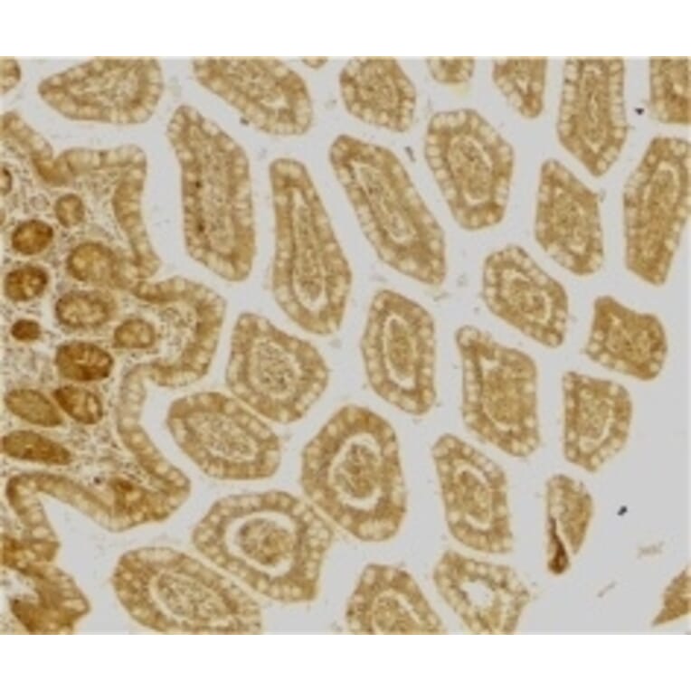 Immunohistochemistry - Anti-DC-SIGN Antibody (A283893) - Antibodies.com