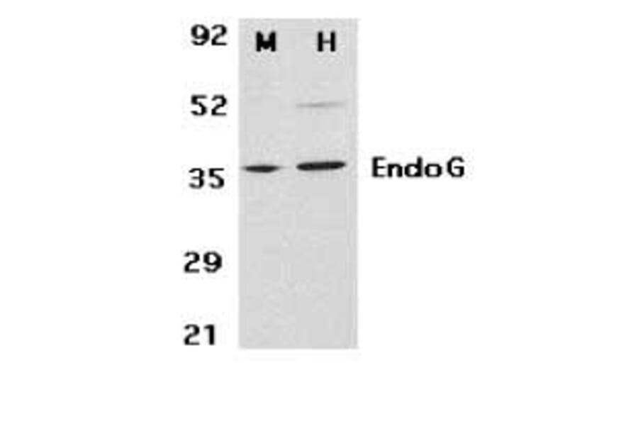 Western Blot - Anti-Endo G Antibody (A283913) - Antibodies.com