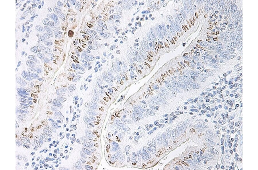 Immunohistochemistry - Anti-CXCL2 Antibody - BSA and Azide free (A283920) - Antibodies.com