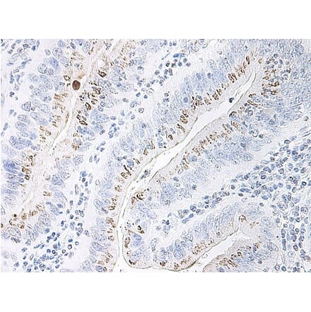 Immunohistochemistry - Anti-CXCL2 Antibody - BSA and Azide free (A283920) - Antibodies.com
