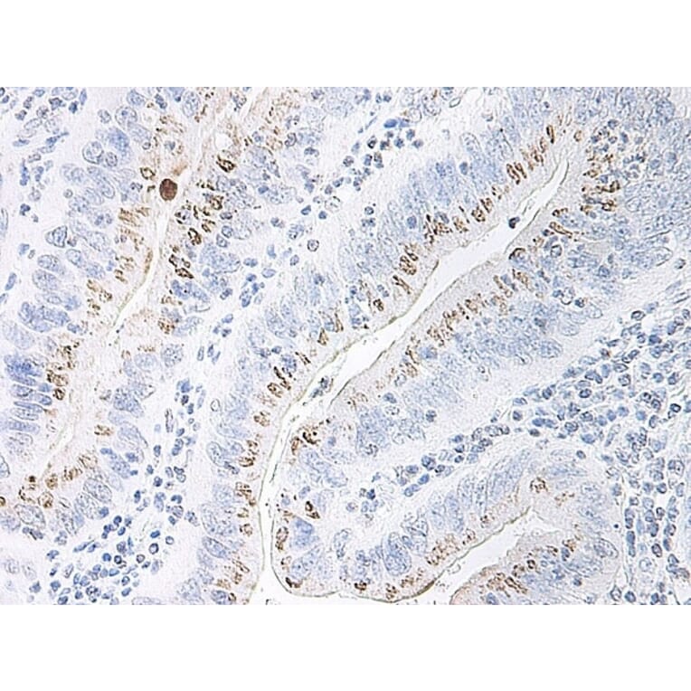 Immunohistochemistry - Anti-CXCL2 Antibody - BSA and Azide free (A283920) - Antibodies.com