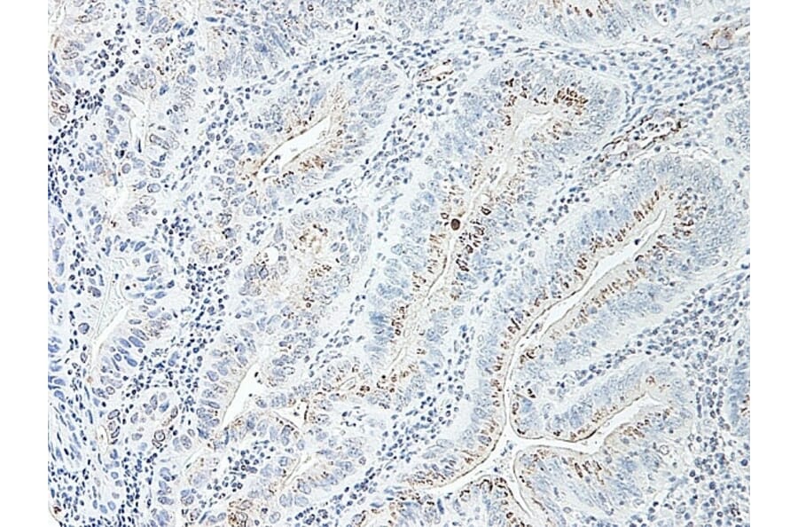 Immunohistochemistry - Anti-CXCL2 Antibody - BSA and Azide free (A283920) - Antibodies.com