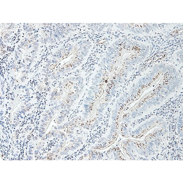 Immunohistochemistry - Anti-CXCL2 Antibody - BSA and Azide free (A283920) - Antibodies.com