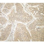 Immunohistochemistry - Anti-Interferon gamma Antibody - BSA and Azide free (A283922) - Antibodies.com