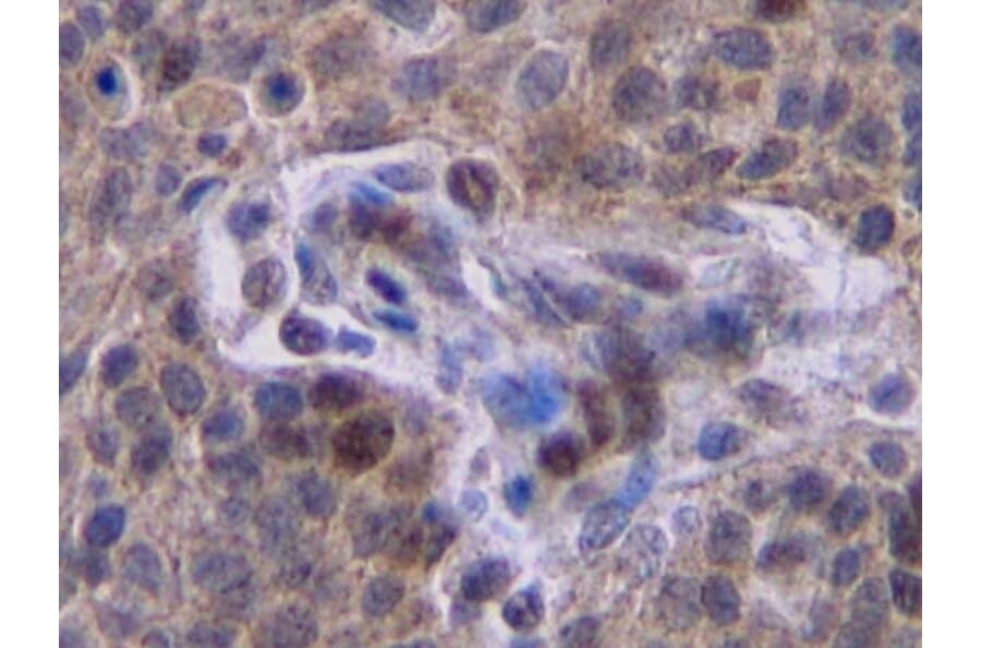 Immunohistochemistry - Anti-Interferon gamma Antibody - BSA and Azide free (A283922) - Antibodies.com
