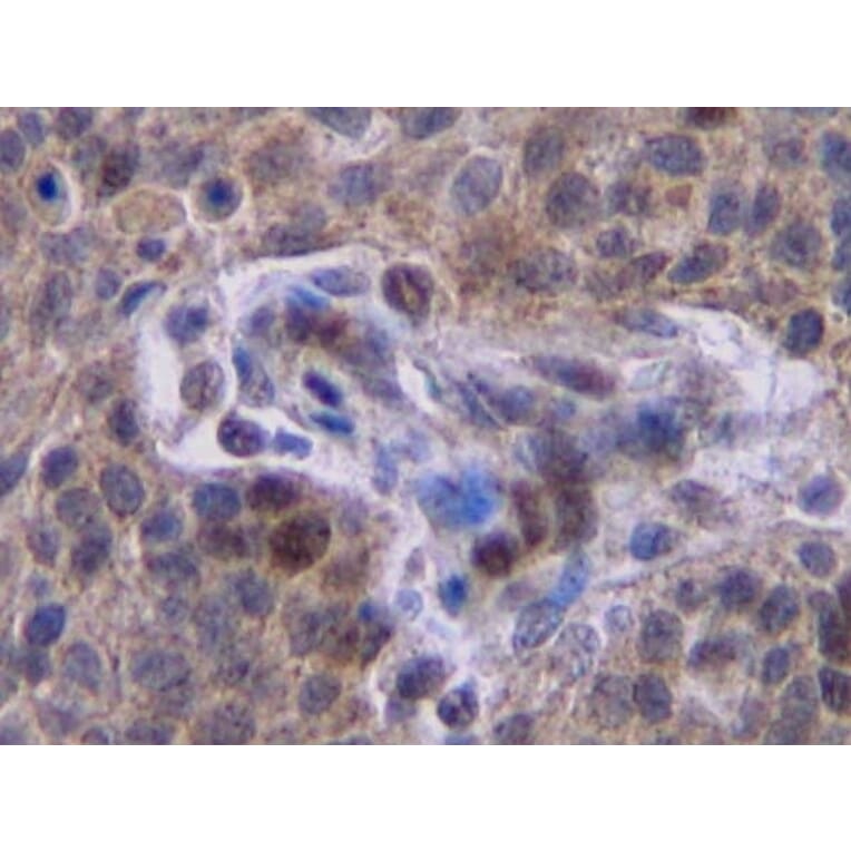 Immunohistochemistry - Anti-Interferon gamma Antibody - BSA and Azide free (A283922) - Antibodies.com