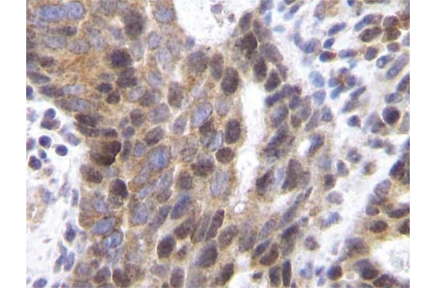 Immunohistochemistry - Anti-SDF1 alpha Antibody - BSA and Azide free (A283936) - Antibodies.com