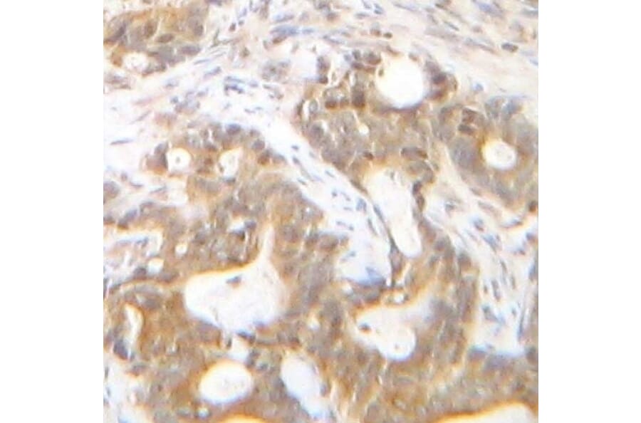 Immunohistochemistry - Anti-SDF1 alpha Antibody - BSA and Azide free (A283936) - Antibodies.com