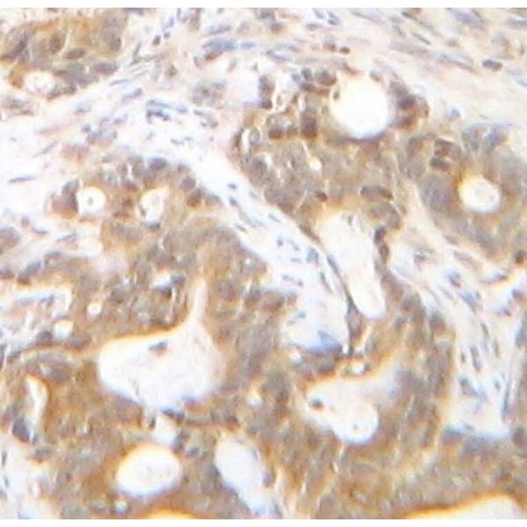 Immunohistochemistry - Anti-SDF1 alpha Antibody - BSA and Azide free (A283936) - Antibodies.com