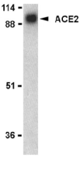 Western Blot - Anti-ACE2 Antibody (A283951) - Antibodies.com