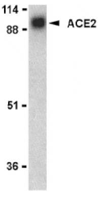 Western Blot - Anti-ACE2 Antibody (A283951) - Antibodies.com