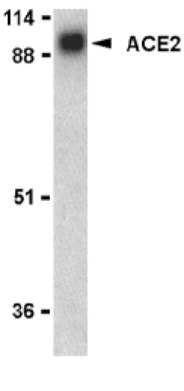 Western Blot - Anti-ACE2 Antibody (A283951) - Antibodies.com