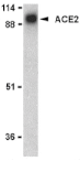 Western Blot - Anti-ACE2 Antibody (A283951) - Antibodies.com