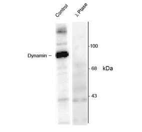 Western Blot - Anti-Dynamin (phospho Ser774) Antibody (A283953) - Antibodies.com