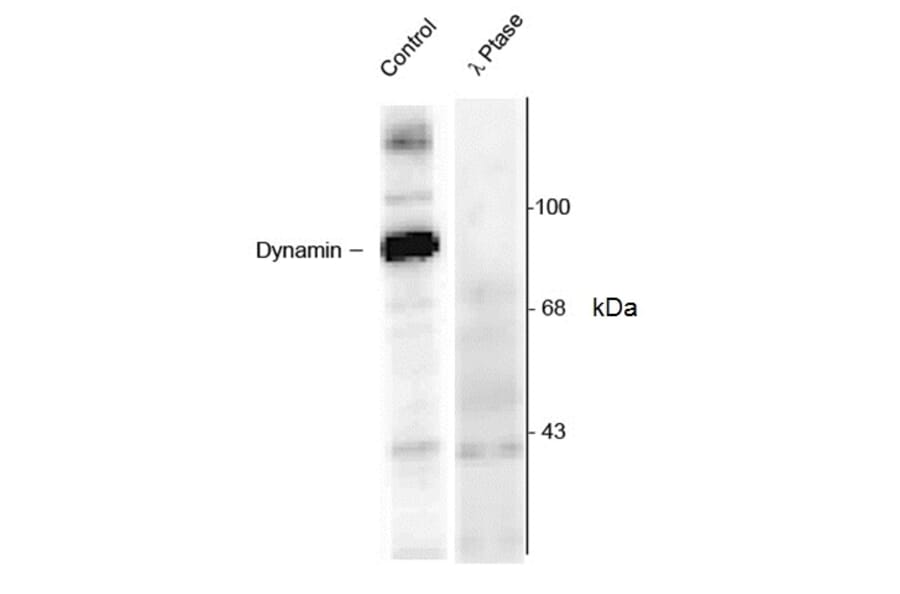 Western Blot - Anti-Dynamin (phospho Ser774) Antibody (A283953) - Antibodies.com