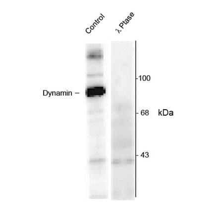Western Blot - Anti-Dynamin (phospho Ser774) Antibody (A283953) - Antibodies.com