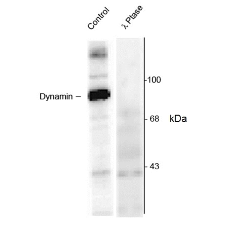 Western Blot - Anti-Dynamin (phospho Ser774) Antibody (A283953) - Antibodies.com