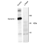 Western Blot - Anti-Dynamin (phospho Ser774) Antibody (A283953) - Antibodies.com