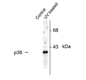 Western Blot - Anti-p38 MAPK (phospho Thr180 + Tyr182) Antibody (A283957) - Antibodies.com
