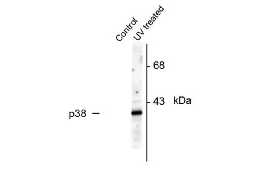 Western Blot - Anti-p38 MAPK (phospho Thr180 + Tyr182) Antibody (A283957) - Antibodies.com