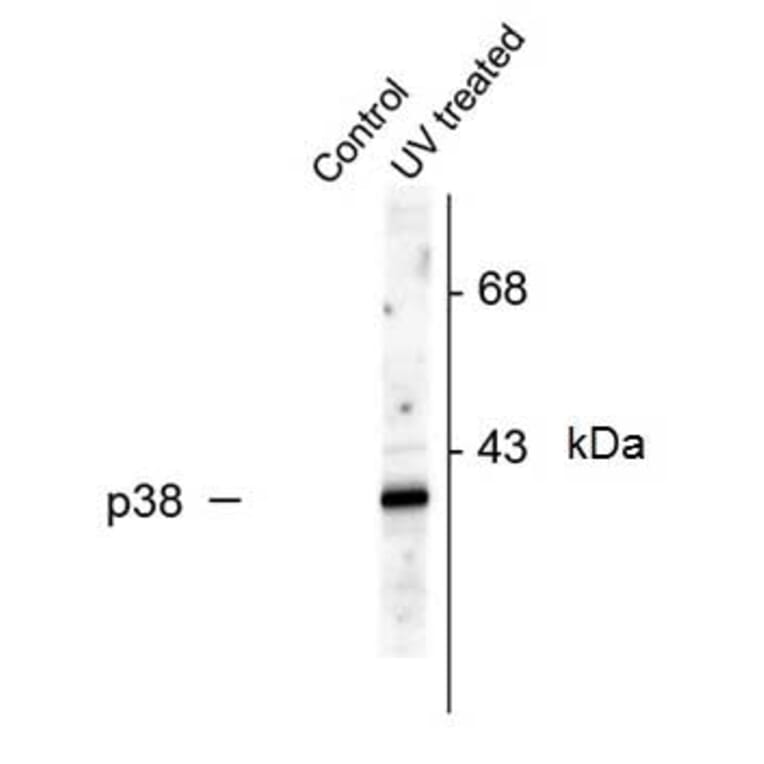 Western Blot - Anti-p38 MAPK (phospho Thr180 + Tyr182) Antibody (A283957) - Antibodies.com