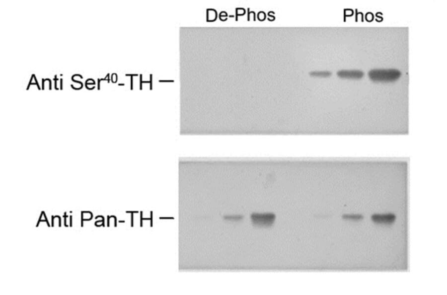 Western Blot - Anti-Tyrosine Hydroxylase (phospho Ser40) Antibody (A283960) - Antibodies.com